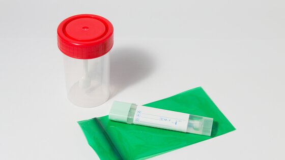 Verschiedene Tests auf Darmkrebs | © AdobeStock-486124785